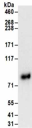 Immunoprecipitation - Anti-HNF1 alpha antibody (AB176818)