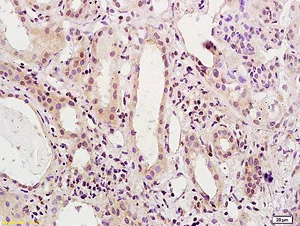 Immunohistochemistry (Formalin/PFA-fixed paraffin-embedded sections) - Anti-HNF1 alpha antibody (AB203092)