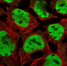 Immunocytochemistry/ Immunofluorescence - Anti-HNF1 alpha antibody (AB204306), expandable thumbnail