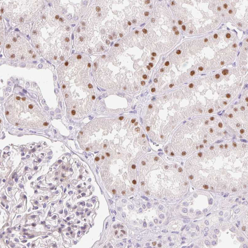 Immunohistochemistry (Formalin/PFA-fixed paraffin-embedded sections) - Anti-HNF1 alpha antibody (AB204306), expandable thumbnail
