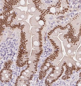 Immunohistochemistry (Formalin/PFA-fixed paraffin-embedded sections) - Anti-HNF1 alpha antibody (AB204306), expandable thumbnail