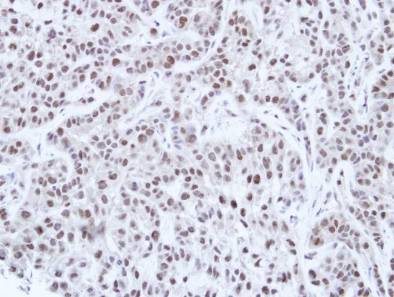 Immunohistochemistry (Formalin/PFA-fixed paraffin-embedded sections) - Anti-HNF1 alpha antibody (AB96777), expandable thumbnail