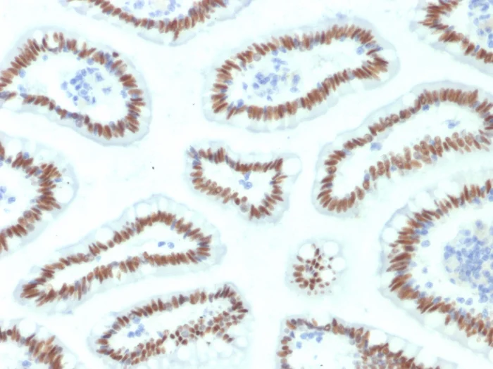 Immunohistochemistry (Formalin/PFA-fixed paraffin-embedded sections) - Anti-HNF1 alpha antibody [HNF1A/2087] (AB268116)