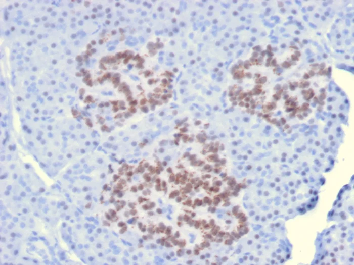 Immunohistochemistry (Formalin/PFA-fixed paraffin-embedded sections) - Anti-HNF1 alpha antibody [HNF1A/2087] (AB268116)