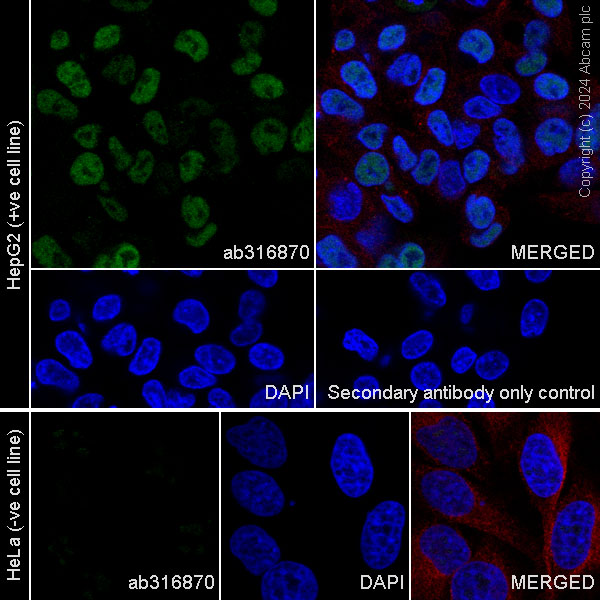 Immunocytochemistry/ Immunofluorescence - Anti-HNF1 alpha antibody [RM1094] (ab316870), expandable thumbnail