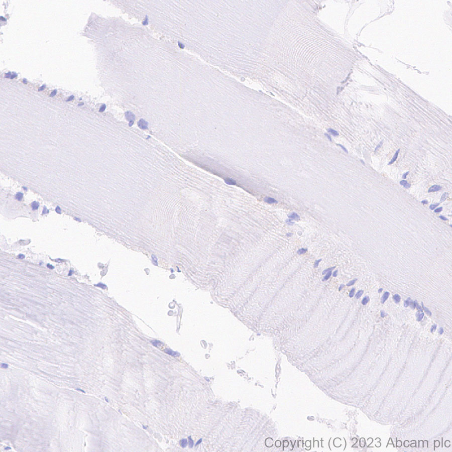 Immunohistochemistry (Formalin/PFA-fixed paraffin-embedded sections) - Anti-HNF1 alpha antibody [RM1094] (ab316870), expandable thumbnail