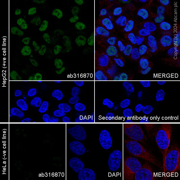 Immunocytochemistry/ Immunofluorescence - Anti-HNF1 alpha antibody [RM1094] - BSA and Azide free (AB316871)