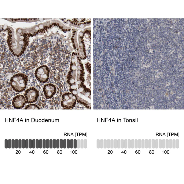 Immunohistochemistry (Formalin/PFA-fixed paraffin-embedded sections) - Anti-HNF4A Antibody (AB327183)