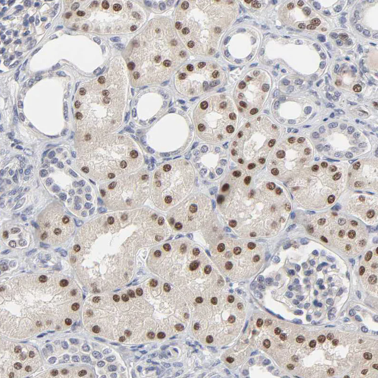 Immunohistochemistry (Formalin/PFA-fixed paraffin-embedded sections) - Anti-HNF4A Antibody (AB327183)