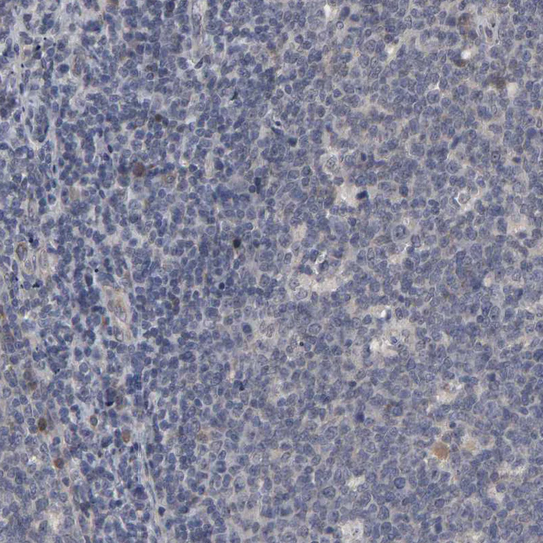 Immunohistochemistry (Formalin/PFA-fixed paraffin-embedded sections) - Anti-HNF4A Antibody (AB327183)
