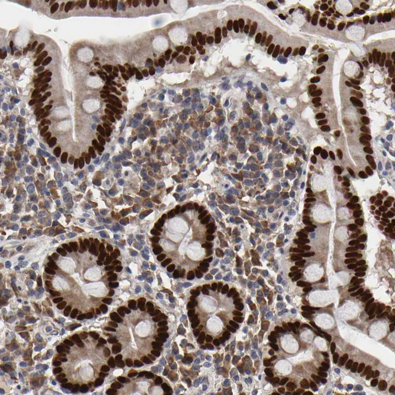 Immunohistochemistry (Formalin/PFA-fixed paraffin-embedded sections) - Anti-HNF4A Antibody (AB327183)