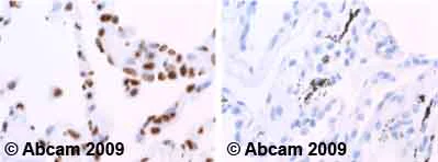 Immunohistochemistry (Formalin/PFA-fixed paraffin-embedded sections) - Anti-hnRNP A1 antibody [9H10] (AB5832)