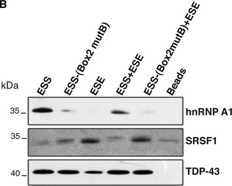 Western blot - Anti-hnRNP A1 antibody [9H10] (AB5832)
