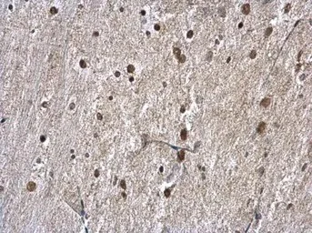 Immunohistochemistry (Formalin/PFA-fixed paraffin-embedded sections) - Anti-hnRNP A1 antibody (AB137780)