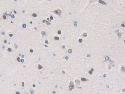 Immunohistochemistry (Formalin/PFA-fixed paraffin-embedded sections) - Anti-hnRNP A1 antibody (AB232824)