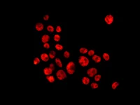Immunocytochemistry/ Immunofluorescence - Anti-hnRNP A1 antibody [EPR12768] (AB177152)