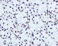 Immunohistochemistry (Formalin/PFA-fixed paraffin-embedded sections) - Anti-hnRNP A1 antibody [EPR12768] (AB177152), expandable thumbnail