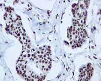 Immunohistochemistry (Formalin/PFA-fixed paraffin-embedded sections) - Anti-hnRNP A1 antibody [EPR12768] - BSA and Azide free (AB240196)