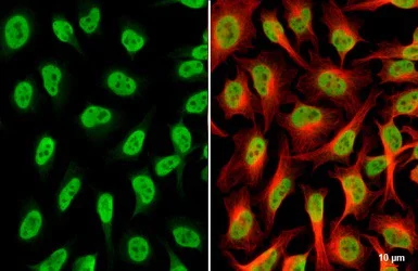 Immunocytochemistry/ Immunofluorescence - Anti-hnRNP A2B1 antibody (AB183654)