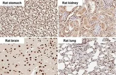 Immunohistochemistry (Formalin/PFA-fixed paraffin-embedded sections) - Anti-hnRNP A2B1 antibody (AB183654)