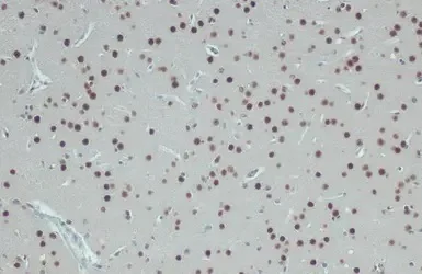Immunohistochemistry (Formalin/PFA-fixed paraffin-embedded sections) - Anti-hnRNP A2B1 antibody (AB183654)