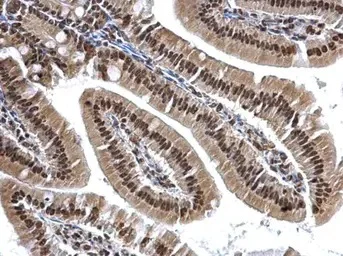 Immunohistochemistry (Formalin/PFA-fixed paraffin-embedded sections) - Anti-hnRNP A2B1 antibody (AB183654)