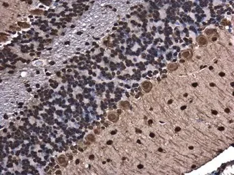 Immunohistochemistry (Formalin/PFA-fixed paraffin-embedded sections) - Anti-hnRNP A2B1 antibody (AB183654)