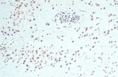 Immunohistochemistry (Formalin/PFA-fixed paraffin-embedded sections) - Anti-hnRNP A2B1 antibody (AB183654)
