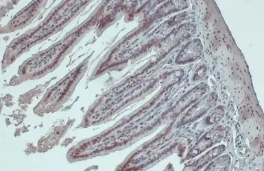 Immunohistochemistry (Formalin/PFA-fixed paraffin-embedded sections) - Anti-hnRNP A2B1 antibody (AB183654)