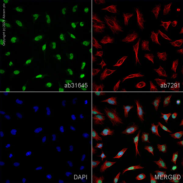 Immunocytochemistry/ Immunofluorescence - Anti-hnRNP A2B1 antibody (AB31645)