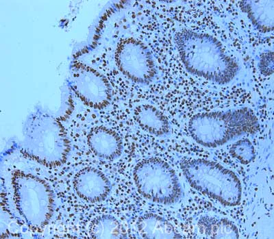 Immunohistochemistry (Formalin/PFA-fixed paraffin-embedded sections) - Anti-hnRNP A2B1 antibody (AB31645)