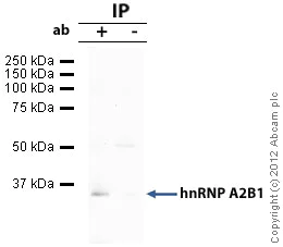 Immunoprecipitation - Anti-hnRNP A2B1 antibody (AB31645)