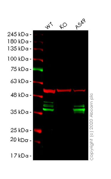Western blot - Anti-hnRNP A2B1 antibody (AB31645)