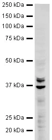 Western blot - Anti-hnRNP A2B1 antibody (AB31645)