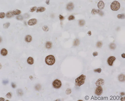 Immunohistochemistry (Formalin/PFA-fixed paraffin-embedded sections) - Anti-hnRNP A2B1 antibody [DP3B3] (AB6102)