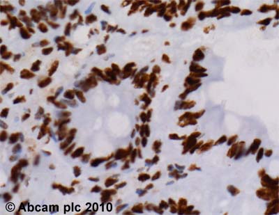 Immunohistochemistry (Formalin/PFA-fixed paraffin-embedded sections) - Anti-hnRNP A2B1 antibody [DP3B3] (AB6102)