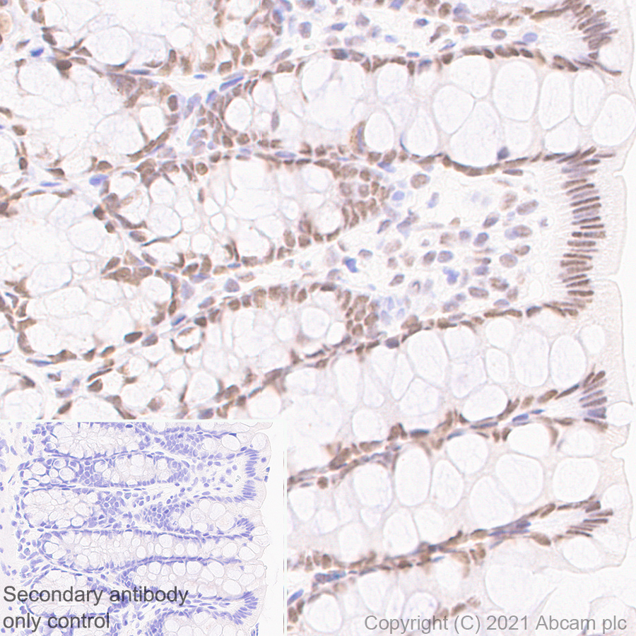 Immunohistochemistry (Formalin/PFA-fixed paraffin-embedded sections) - Anti-hnRNP A2B1 antibody [EPR24002-81] - BSA and Azide free (ab283592), expandable thumbnail