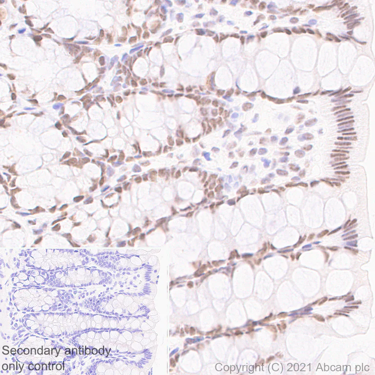 Immunohistochemistry (Formalin/PFA-fixed paraffin-embedded sections) - Anti-hnRNP A2B1 antibody [EPR24002-81] - BSA and Azide free (AB283592)