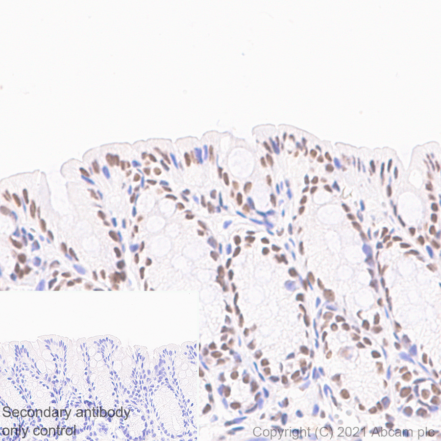 Immunohistochemistry (Formalin/PFA-fixed paraffin-embedded sections) - Anti-hnRNP A2B1 antibody [EPR24002-81] - BSA and Azide free (ab283592), expandable thumbnail