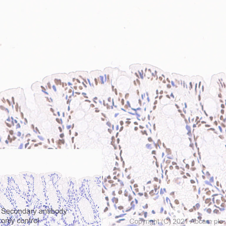 Immunohistochemistry (Formalin/PFA-fixed paraffin-embedded sections) - Anti-hnRNP A2B1 antibody [EPR24002-81] - BSA and Azide free (AB283592)