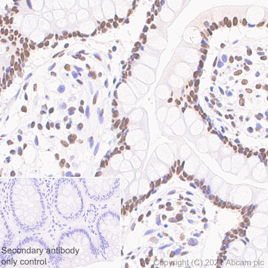 Immunohistochemistry (Formalin/PFA-fixed paraffin-embedded sections) - Anti-hnRNP A2B1 antibody [EPR24002-81] - BSA and Azide free (AB283592), expandable thumbnail