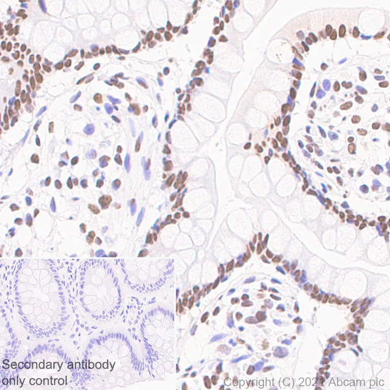 Immunohistochemistry (Formalin/PFA-fixed paraffin-embedded sections) - Anti-hnRNP A2B1 antibody [EPR24002-81] - BSA and Azide free (AB283592)