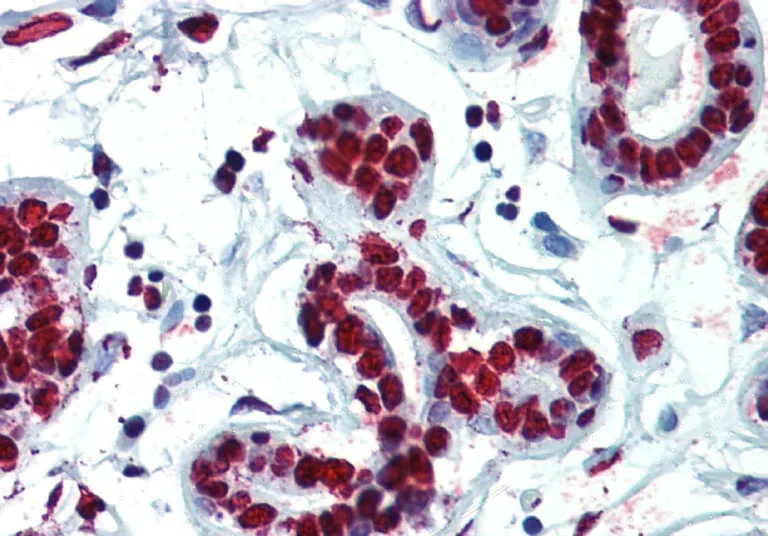 Immunohistochemistry (Formalin/PFA-fixed paraffin-embedded sections) - Anti-hnRNP C1/C2 Antibody [4F4] (AB316365)