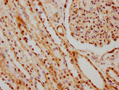 Immunohistochemistry (Formalin/PFA-fixed paraffin-embedded sections) - Anti-hnRNP C1/C2 antibody [9G1] (AB314004), expandable thumbnail