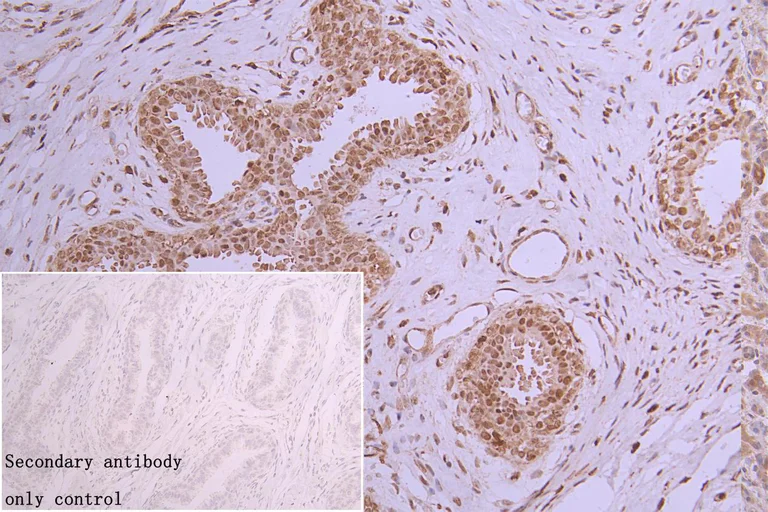 Immunohistochemistry (Formalin/PFA-fixed paraffin-embedded sections) - Anti-hnRNP C1/C2 antibody [9G1] (AB314004)