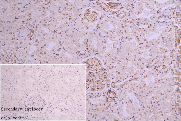 Immunohistochemistry (Formalin/PFA-fixed paraffin-embedded sections) - Anti-hnRNP C1/C2 antibody [9G1] (AB314004)