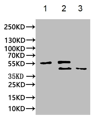 Immunoprecipitation - Anti-hnRNP C1/C2 antibody [9G1] (AB314004)