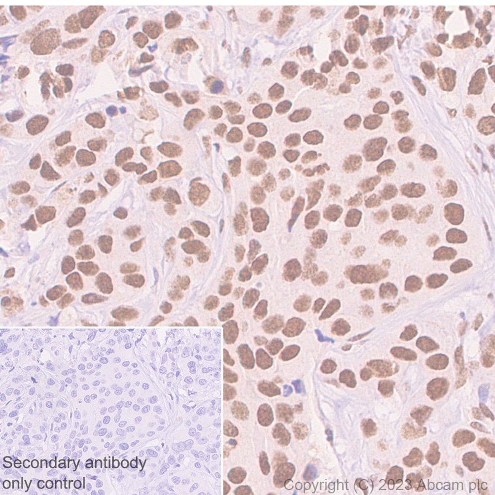 Immunohistochemistry (Formalin/PFA-fixed paraffin-embedded sections) - Anti-hnRNP C1/C2 antibody [EP3034Y] (AB75822), expandable thumbnail