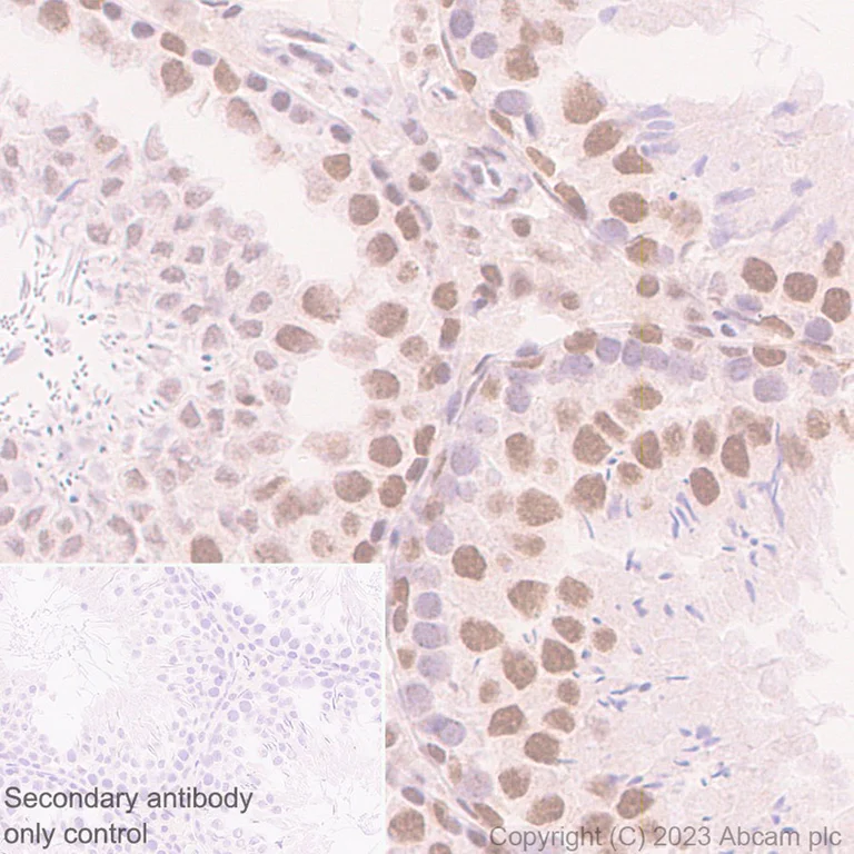 Immunohistochemistry (Formalin/PFA-fixed paraffin-embedded sections) - Anti-hnRNP C1/C2 antibody [EP3034Y] (AB75822)