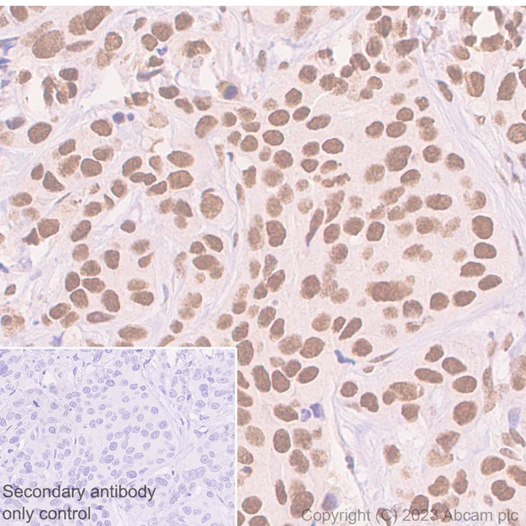 Immunohistochemistry (Formalin/PFA-fixed paraffin-embedded sections) - Anti-hnRNP C1/C2 antibody [EP3034Y] - BSA and Azide free (AB284719)